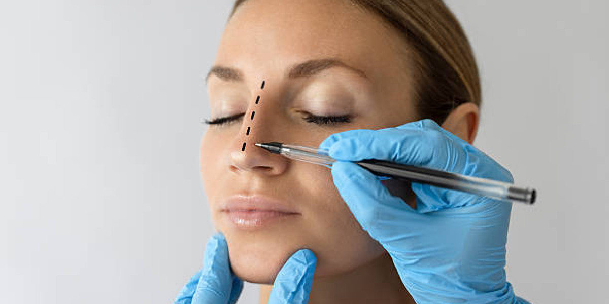 Exploring Non-Surgical Rhinoplasty Options in Riyadh