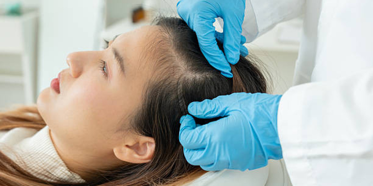 Exosome Therapy For Hair Loss And Scalp Healing Naturally Explained