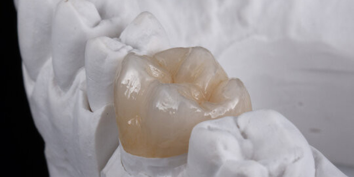 What Makes Zirconia Crown in Islamabad the Best Dental Choice?