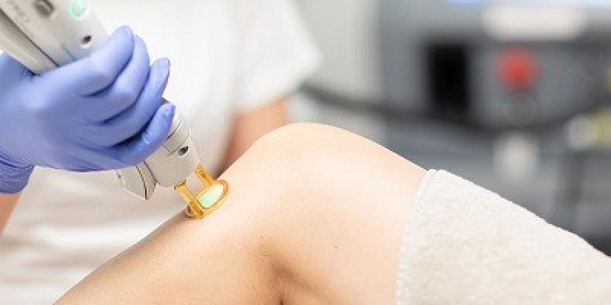Achieve Smooth and Hair-Free Legs with Advanced Leg Laser in Dubai